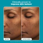 Paula’s Choice 6% Mandelic Acid + 2% Lactic Acid Exfoliant, Gentle Daily AHA Exfoliation for Discoloration, Bumpy Texture & Radiance, for Sensitive Skin, Fragrance-Free - Image 5