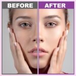 Skin Care Set,6 Pcs Anti-aging Skincare w/Korean Retinol,Hydrate, Moisturize Self Care Facial Skin Care Routine Kit Women Teen Girls Travel Skincare Gift Set,Valentines Birthday Gift for Women Her Mom - Image 2