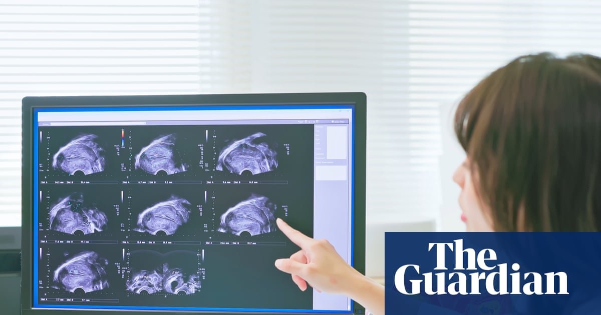 Trial of non-invasive endometriosis scan boosts hopes for quicker diagnosis | Endometriosis