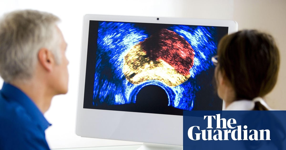 Fewer men should get prostate cancer screening, committee recommends | Prostate cancer